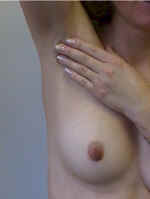 Feel the armpit during a Breast Self Exam