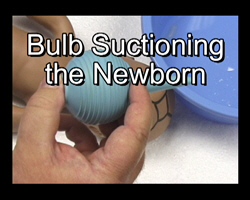Bulb suctioning of the Newborn