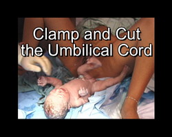 Clamp and cut the umbilical cord
